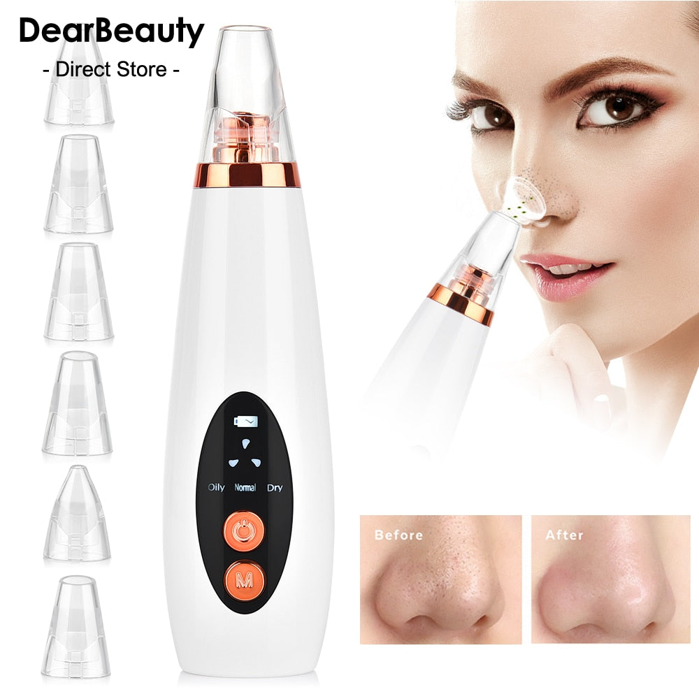 Blackhead Remover Vacuum